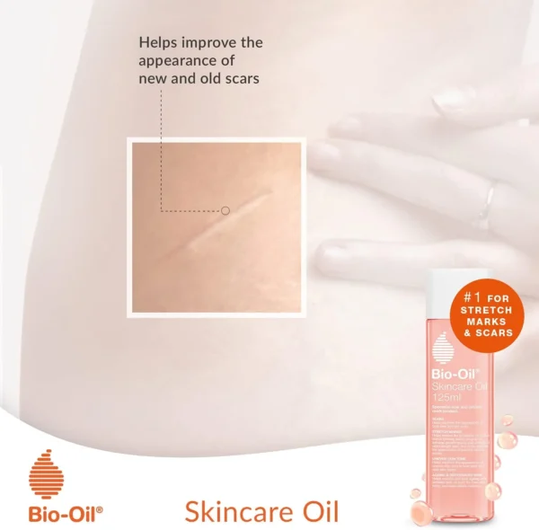 Bio-Oil Skincare Oil - 1 x 200 ml - Image 5