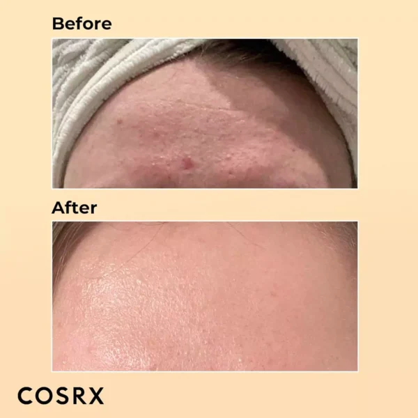 COSRX Advanced Snail 96 Mucin - Skin Repair & Hydrating Serum - Image 2